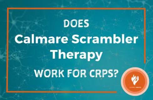 Does Calmare Scrambler Therapy work for CRPS? Burning Nights CRPS Support.