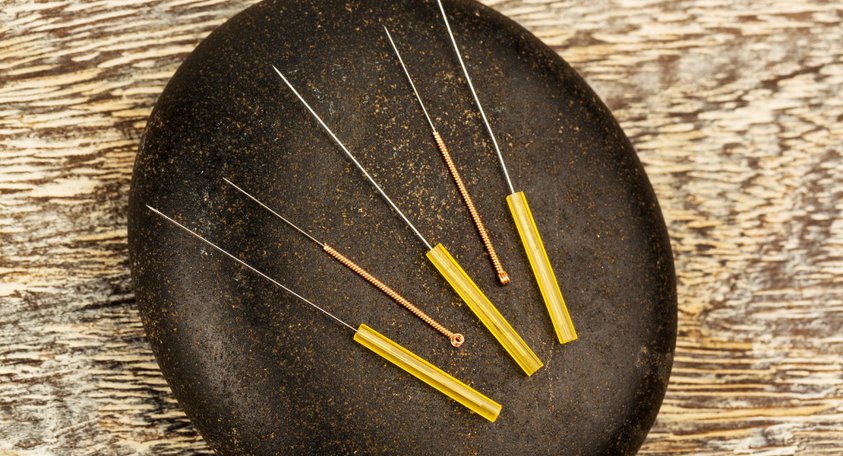 Acupuncture for CRPS | acupuncture needles on a smooth stone