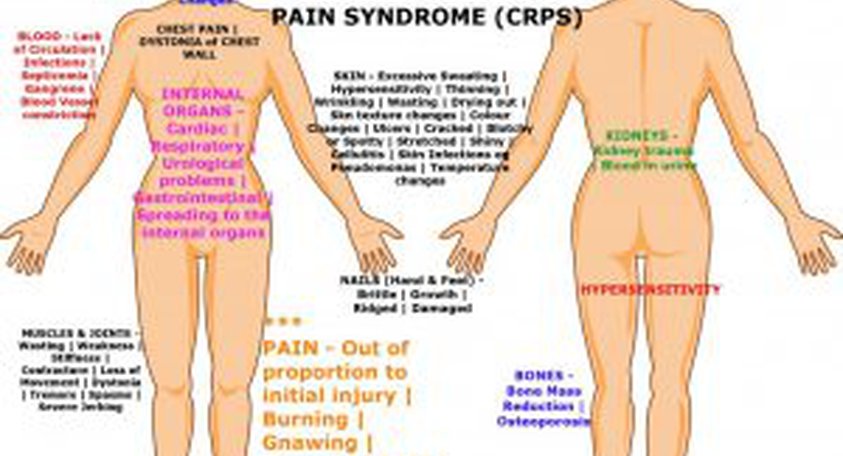 CRPS Symptoms | CRPS Signs | RSD Signs | RSD Symptoms
