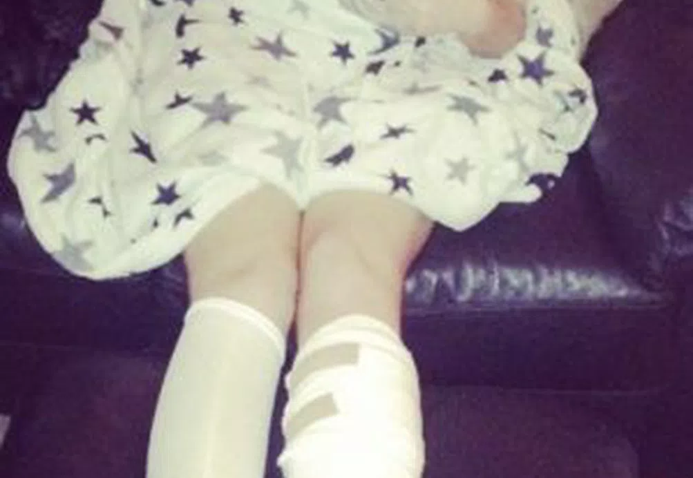 Jessica's CRPS story - trying to bake after 3rd operation