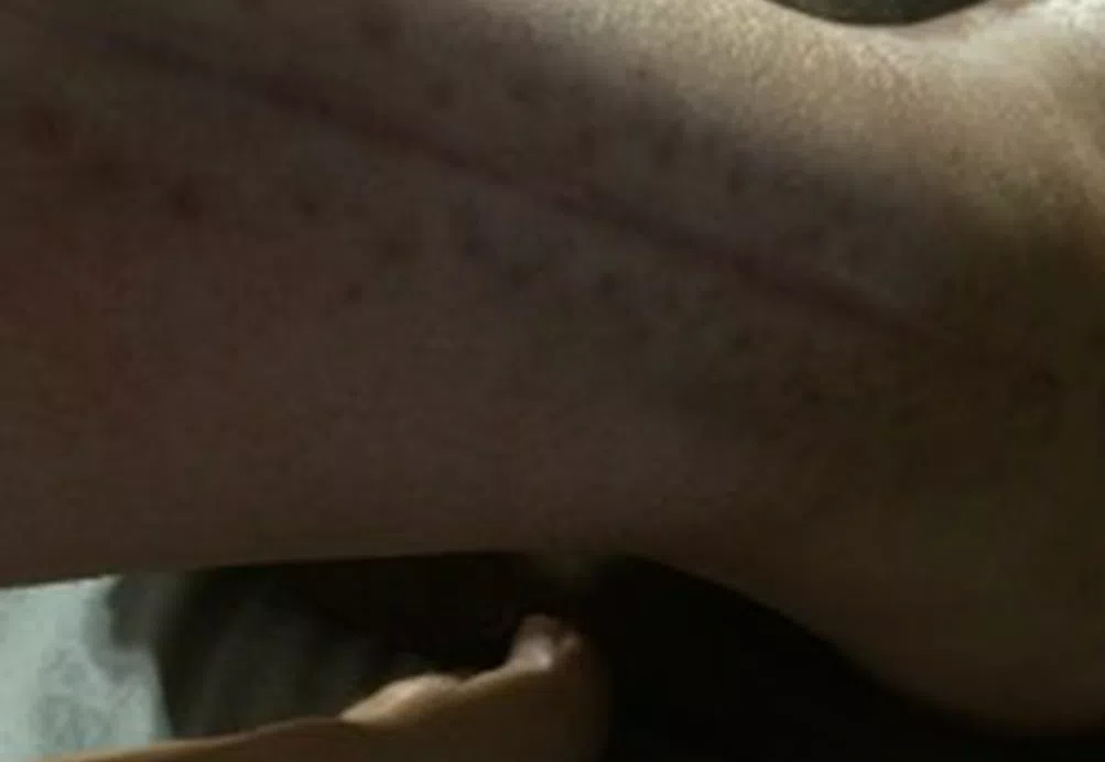 New CRPS Story 5 2014-12-29