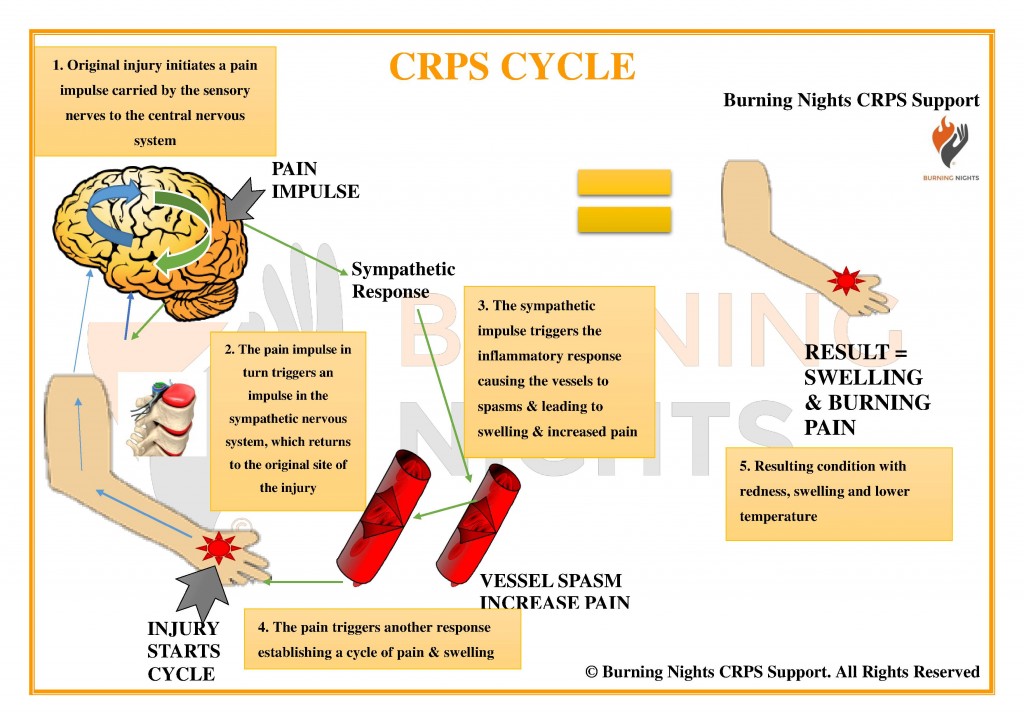 What is CRPS | What is RSD? | CRPS cycle | Burning Nights CRPS SupportWhat is CRPS? | What is RSD? | CRPS cycle | Burning Nights CRPS Support | RSD CRPS